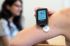 HCP Guide Second-Generation Flash Glucose Monitoring